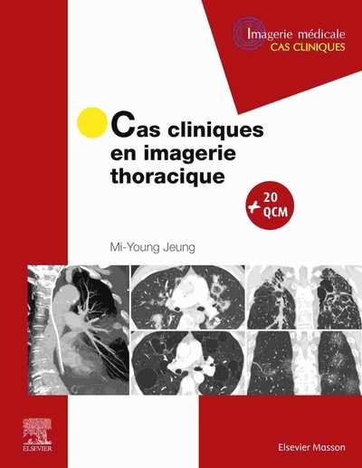 Cas cliniques en imagerie thoracique (Mi-Young Jeung)