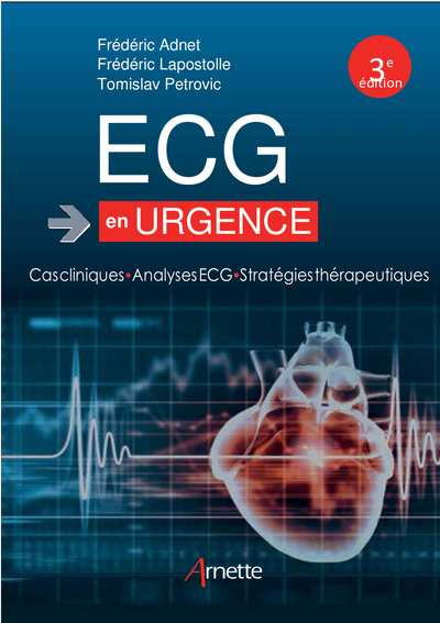 ECG en urgence 2018 Cas cliniques - Analyses ECG - Stratégies thérapeutique Ed. 3 2018