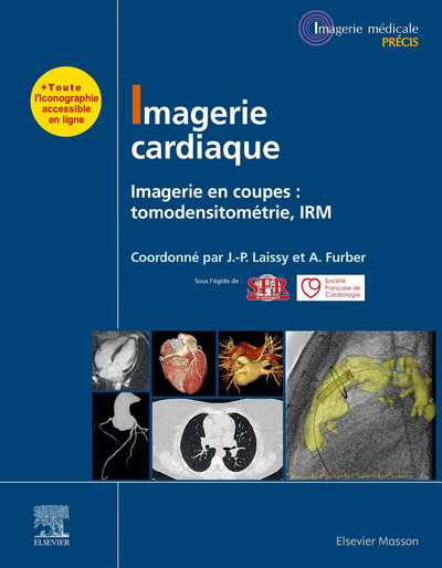 Imagerie cardiaque Imagerie en coupes  scanner, IRM (Alain Furber, Jean-Pierre L