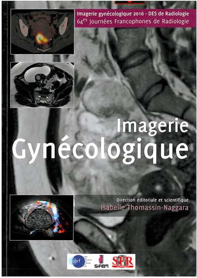 imagerie gynécologique 2016-2017
