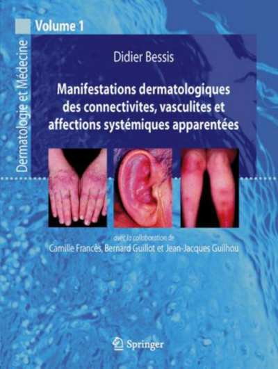 Manifestations_dermatologiques_des_connectivites_Vol_1